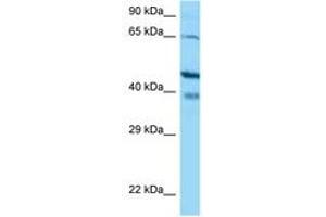 Image no. 1 for anti-S100 Calcium Binding Protein G (S100G) (AA 108-157) antibody (ABIN6748472) (S100G anticorps  (AA 108-157))