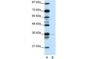 WB Suggested Anti-NANOG Antibody   Titration: 1. (Nanog anticorps  (N-Term))