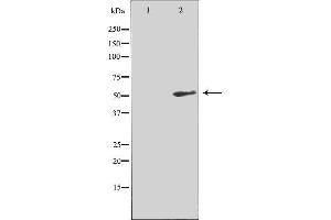Western blot analysis of extracts from COLO205 cells, using NK3R antibody. (TACR3 anticorps  (C-Term))