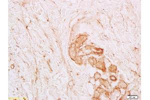 Formalin-fixed and paraffin embedded human skin labeled with Anti-Collagen-VI-alpha1 Polyclonal Antibody , Unconjugated at 1:100, followed by conjugation to the secondary antibody and DAB staining