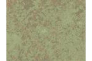 Hsp60 (LK 2), Listeria infected mice spleens 6 days after infection with L monocytogenes. (HSPD1 anticorps)