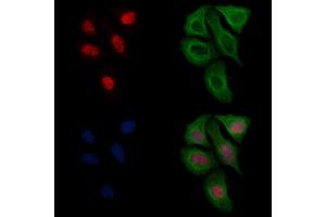 ABIN6256541 and ABIN6267174 staining heat-shock treated Hela cells by IF/ICC. (SF3B1 anticorps  (pThr313))