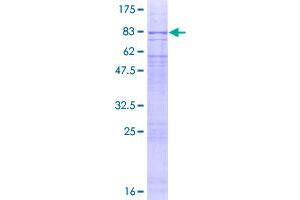 Image no. 1 for Pleiotropic Regulator 1 (PLRG1) (AA 1-514) protein (GST tag) (ABIN1315459)