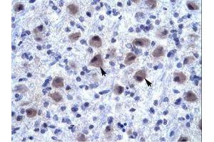 Image no. 1 for anti-Ring Finger Protein 141 (RNF141) (AA 96-145) antibody (ABIN6735889)