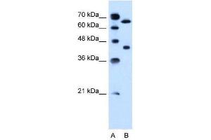 Lane A: Marker Lane B: Jurkat Cell Lysate (SLCO1A2 anticorps  (AA 201-250))