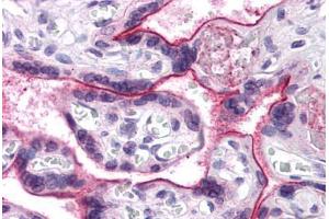 Human Placenta: Formalin-Fixed, Paraffin-Embedded (FFPE) (CDC16 anticorps  (N-Term))