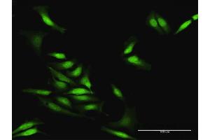 Immunofluorescence of purified MaxPab antibody to STAU2 on HeLa cell.