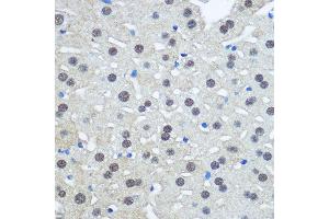 Immunohistochemistry of paraffin-embedded Rat liver using UB antibody (2359) at dilution of 1:100 (40x lens). (UBA1 anticorps  (AA 300-600))