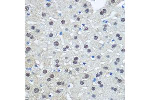 Immunohistochemistry of paraffin-embedded Rat liver using UB antibody (2359) at dilution of 1:100 (40x lens). (UBA1 anticorps  (AA 300-600))