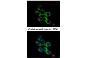 ICC/IF Image Immunofluorescence analysis of methanol-fixed A431, using BBOX1, antibody at 1:500 dilution.