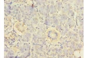 Immunohistochemistry of paraffin-embedded human pancreatic tissue using ABIN7142524 at dilution of 1:100 (RPS24 anticorps  (AA 2-133))