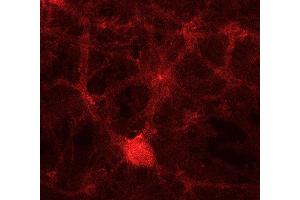 Indirect immunostaining of PFA fixed rat hippocampus neurons (dilution 1 : 500).