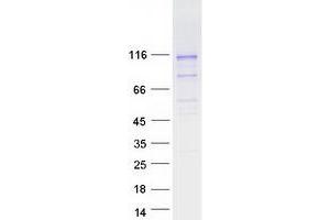 Validation with Western Blot