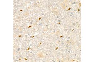Immunohistochemistry of paraffin embedded mouse spinal cord using ANXA3 (ABIN7073065) at dilution of 1: 200 (400x lens)