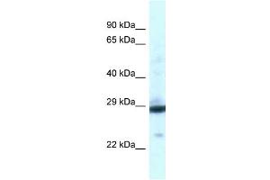WB Suggested Anti-PGAM1 Antibody Titration: 1. (PGAM1 anticorps  (C-Term))