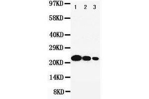 Anti-IL6 antibody, Western blotting Lane 1: Recombinant Human IL-6 Protein 10ng Lane 2: Recombinant Human IL-6 Protein 5ng Lane 3: Recombinant Human IL-6 Protein 2.