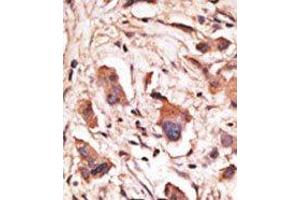 Image no. 1 for anti-Melanoma Antigen Family D, 1 (MAGED1) (Middle Region) antibody (ABIN358657)
