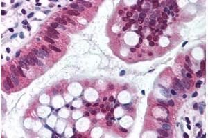 Human Small Intestine (formalin-fixed, paraffin-embedded) stained with SRI antibody ABIN290232 at 10 ug/ml followed by biotinylated goat anti-rabbit IgG secondary antibody ABIN481713, alkaline phosphatase-streptavidin and chromogen. (SRI anticorps  (AA 50-100))