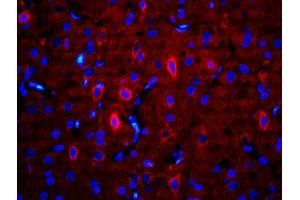 Formalin-fixed and paraffin-embedded rat brain labeled with Anti-RALDH2 Polyclonal Antibody, Unconjugatedused at 1:200 dilution for 40 minutes at 37°C.