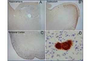 Extensive OC labeling was observed in the hippocampus (A), subiculum (B) and frontal cortex (C) in Alzheimer disease. (Amyloid Fibrils anticorps)