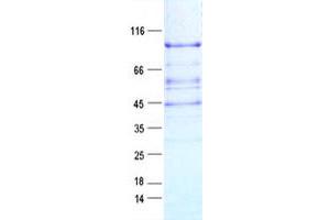 Validation with Western Blot
