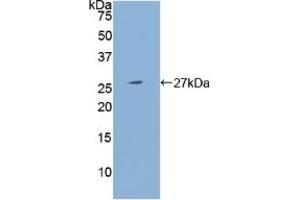 Detection of Recombinant PSG1, Human using Polyclonal Antibody to Pregnancy Specific Beta-1-Glycoprotein 1 (PSG1) (PSG1 anticorps  (AA 202-401))
