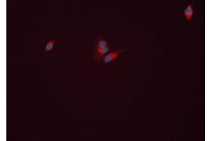 anti-Glutamate-Ammonia Ligase (GLUL) (C-Term) antibody