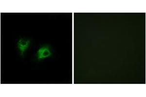 Immunofluorescence analysis of COS7 cells, using CELSR2 Antibody. (CELSR2 anticorps  (AA 2781-2830))