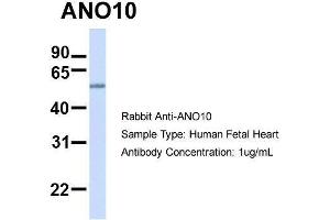 Hum. (Anoctamin 10 anticorps  (C-Term))