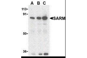 Western Blotting (WB) image for anti-Sterile alpha and TIR Motif Containing 1 (SARM1) (C-Term) antibody (ABIN2476424)