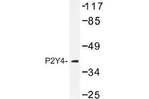 Image no. 1 for anti-Pyrimidinergic Receptor P2Y, G-Protein Coupled, 4 (P2RY4) antibody (ABIN317768) (P2RY4 anticorps)