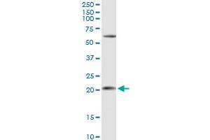 APRT MaxPab rabbit polyclonal antibody. (APRT anticorps  (AA 1-180))