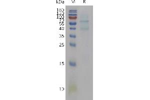 Mouse Protein, His Tag on SDS-PAGE under reducing condition.