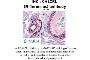Image no. 1 for anti-Calcitonin Receptor-Like (CALCRL) (Extracellular Domain), (N-Term) antibody (ABIN1732561) (CALCRL anticorps  (Extracellular Domain, N-Term))