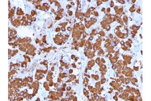 Formalin-fixed, paraffin-embedded human Pituitary stained with Growth Hormone Monoclonal Antibody (GH/1371).