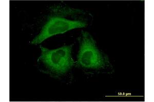 Immunofluorescence of monoclonal antibody to HSPB6 on HeLa cell.