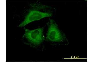Immunofluorescence of monoclonal antibody to HSPB6 on HeLa cell. (HSPB6 anticorps  (AA 1-160))