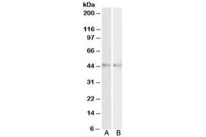 Western blot testing of mouse [A] and rat [B] eye lysates with RNF13 antibody at 2ug/ml. (RNF13 anticorps)