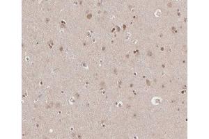 ABIN6266665 at 1/100 staining human brain tissue sections by IHC-P. (TRADD anticorps)
