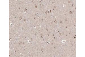 ABIN6266665 at 1/100 staining human brain tissue sections by IHC-P.