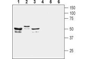 Western blot analysis of mouse brain lysate (lanes 1 and 4), human SHSY-5Y neuroblastoma cell line lysate (lanes 2 and 5) and rat brain membranes (lanes 3 and 6): - 1-3.
