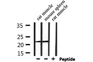 Western blot analysis of extracts from rat muscle,mouse spleen, using PRDX2 Antibody. (Peroxiredoxin 2 anticorps  (C-Term))