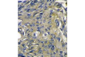 VEGFD (VEGF4) Antibody (C-term) B immunohistochemistry analysis in formalin fixed and paraffin embedded mouse heart tissue followed by peroxidase conjugation of the secondary antibody and DAB staining. (VEGFD (VEGF4) (AA 322-352), (C-Term) anticorps)