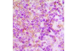 Immunohistochemical analysis of p40 phox staining in human tonsil formalin fixed paraffin embedded tissue section.