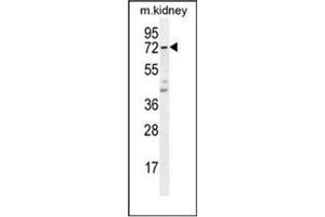 Western blot analysis of TBXAS1 Antibody  in Mouse kidney tissue lysates (35ug/lane). (TBXAS1 anticorps  (Middle Region))
