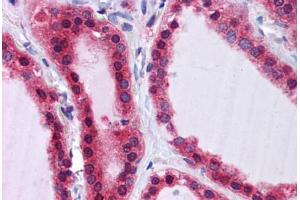 Human Thyroid: Formalin-Fixed, Paraffin-Embedded (FFPE)