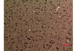 Immunohistochemistry (IHC) analysis of paraffin-embedded Rat Brain, antibody was diluted at 1:100.