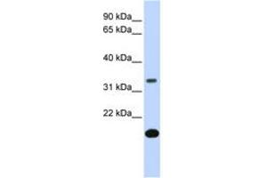 Image no. 1 for anti-Follistatin (FST) (AA 144-193) antibody (ABIN6743094) (Follistatin anticorps  (AA 144-193))