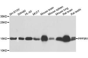 Western blot analysis of extracts of various cells, using PPP3R1 antibody. (PPP3R1 anticorps)