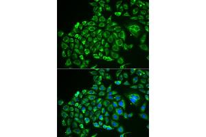 Immunofluorescence analysis of MCF-7 cells using RCVRN antibody (ABIN5973805). (Recoverin anticorps)